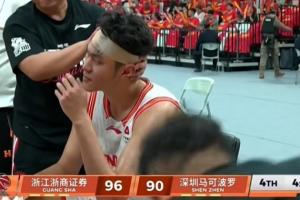 吓人！布朗落地一肘砸在王浩然头上 后者直接头破血流缠上绷带